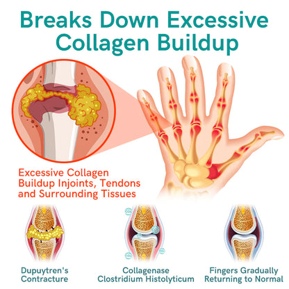 GFOUK™ Collagenase and Bone Therapy Cream
