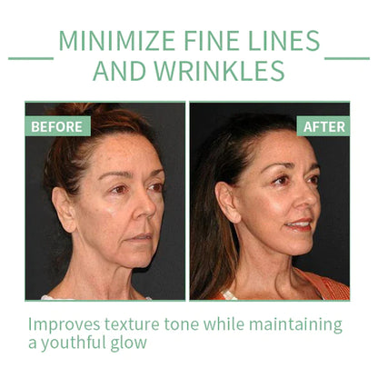 🔥 LOVILDS Collagen Boost Anti-Aging Serum For Remove 97% Deep Wrinkles & Dark Spots