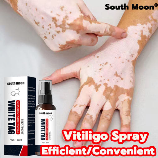 🌿 Herbal Vitiligo Relief Spray 🎉: Nature's Touch for Even Skin Tone ✨